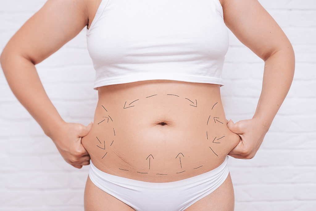 Non-Invasive Body Sculpting (Body Sculpting Pros and Cons)